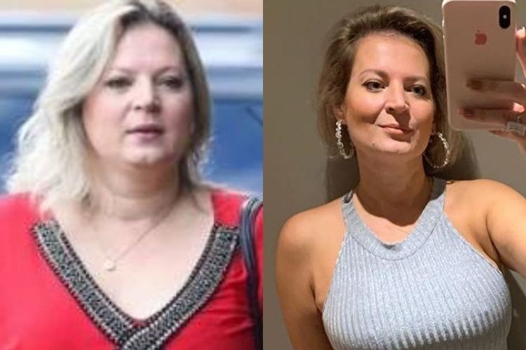 Deputada Joice Hasselmann Que Perdeu 20 Quilos Diz Que Nao Fez Cirurgia Especialista Rebate Wscom